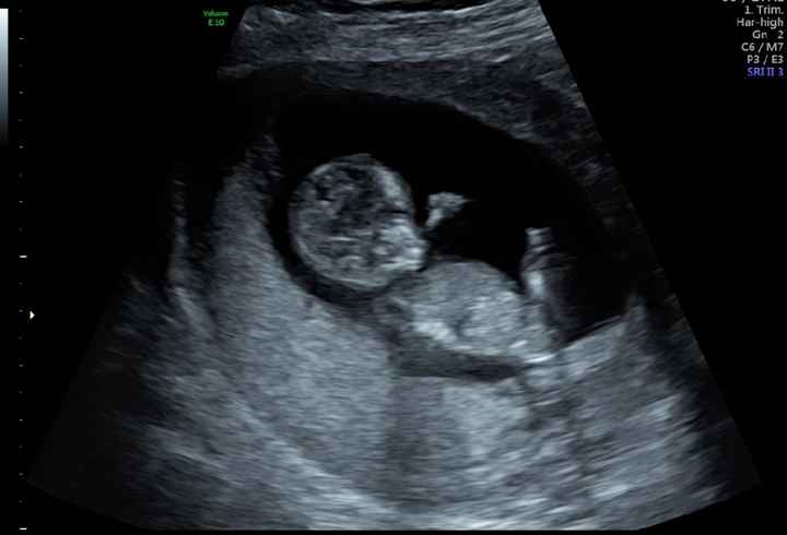 Futuras mamás septiembre 2019 - 1