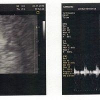 Futuras mamás septiembre 2019 - 1