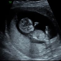 Futuras mamás septiembre 2019 - 1