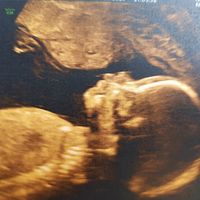 Futuras mamás septiembre 2019 - 2