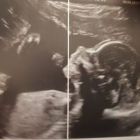 Futuras mamas julio 2019 - 1