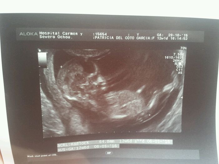 El consultorio de Lita para futuras mamis - 1