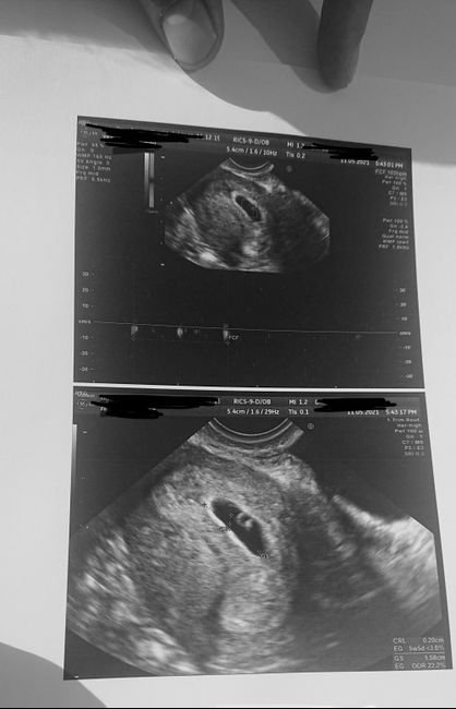 Ayuda con método ramzi: niño o niña? - 1