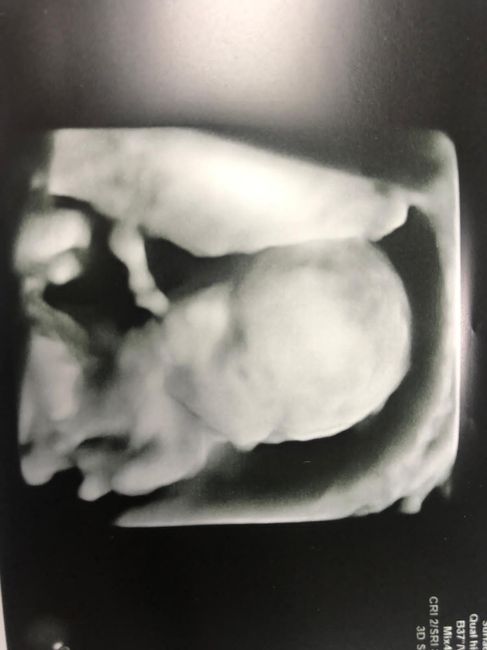 Futuras mamis junio 2021 🤰🏻❤️ oficial - 1