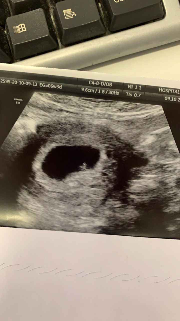 Futuras mamis junio 2021 🤰🏻❤️ oficial - 1