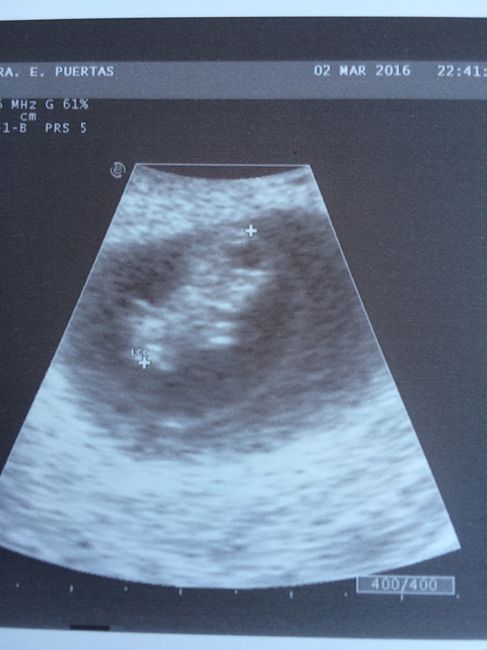 Futuras mamis octubre 2016 - 2