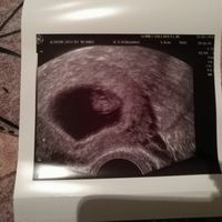 Mamis septiembre 2017 - 1