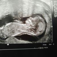 Mamis septiembre 2017 - 1