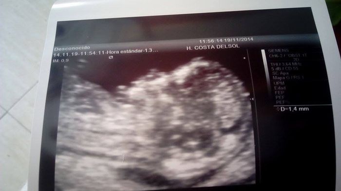mi bebe 