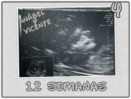 Embarazo Miguelito! subimos fotitos?  - 4