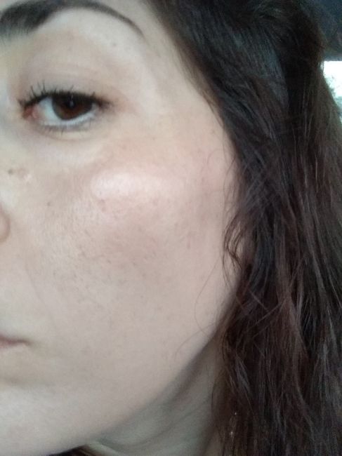 Cremas para disminuir manchas en la cara 2