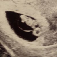 Ayuda con método ramzi: niño o niña? - 1