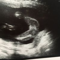 ¡nuevo! futuras mamis de octubre 2017 - 1