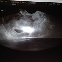 Futuras mamis Marzo 2021 ❤️❤️ - 1