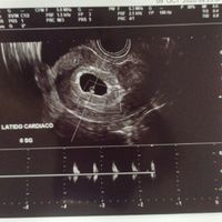 Futuras mamis junio 2021 🤰🏻❤️ oficial - 1