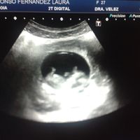 El consultorio de Lita para futuras mamis - 1