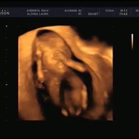 Super mamis de  Junio del 2015 - 1