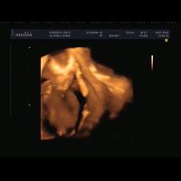 El consultorio de Lita para futuras mamis - 1