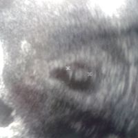 El consultorio de Lita para futuras mamis - 2
