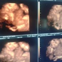 El consultorio de Lita para futuras mamis - 1