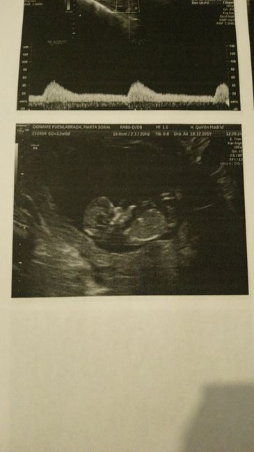 Futuras Mamas Julio 2020. - 1