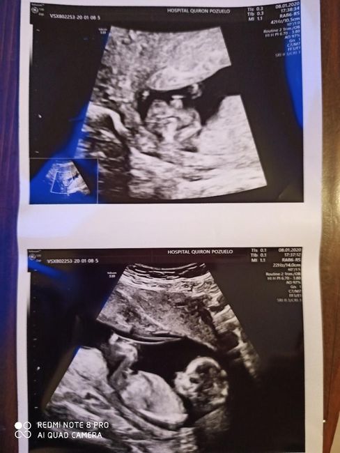 Futuras Mamas Julio 2020. - 1