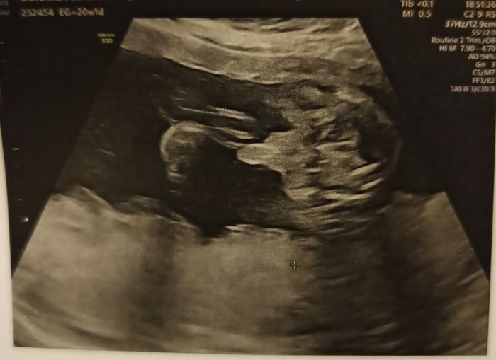 Futuras Mamas Julio 2020. - 1