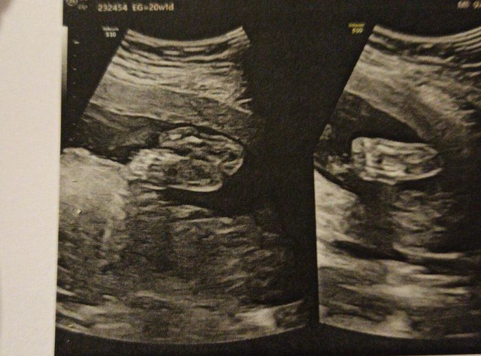 Futuras Mamas Julio 2020. - 2