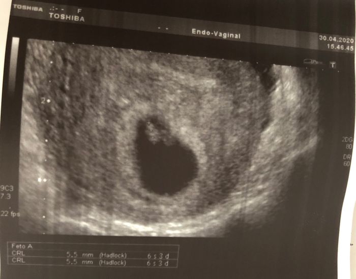 Futuras mamas Diciembre 2020 - 1