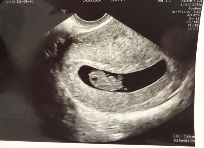 Futuras mamas Diciembre 2020 - 1