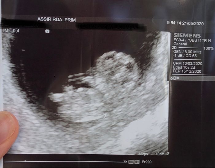 Futuras mamas Diciembre 2020 - 1