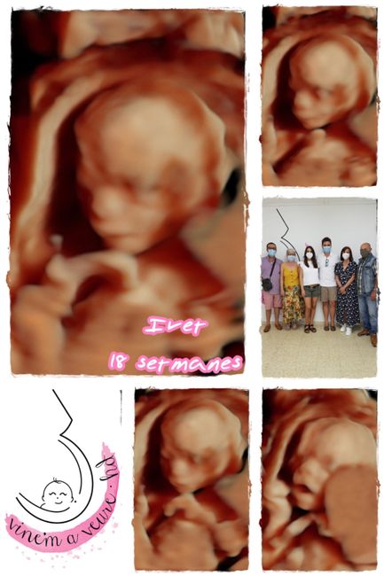 Futuras mamas Diciembre 2020 - 1