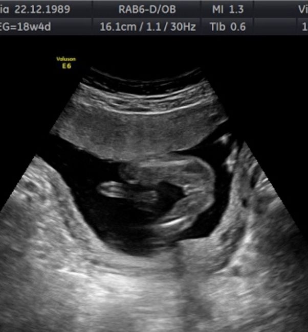 Futuras mamas Diciembre 2020 - 1