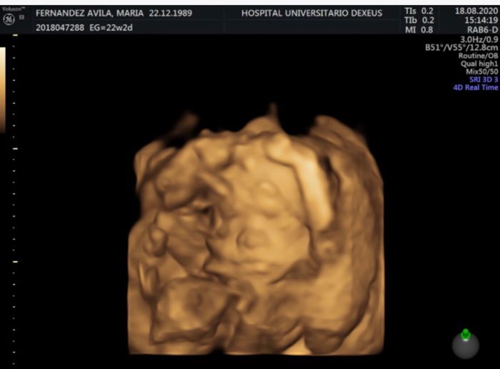 Futuras mamas Diciembre 2020 - 1