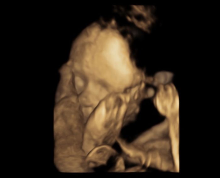 Futuras mamas Diciembre 2020 - 1