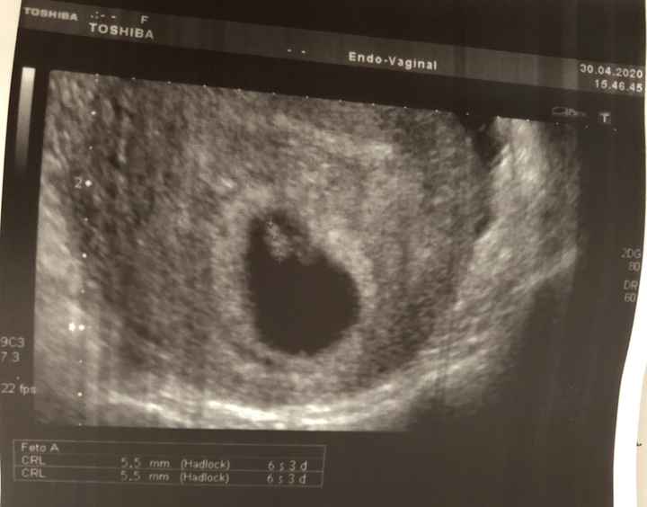 Futuras mamas Diciembre 2020 - 1