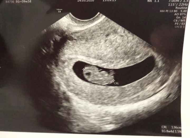 Futuras mamas Diciembre 2020 - 1