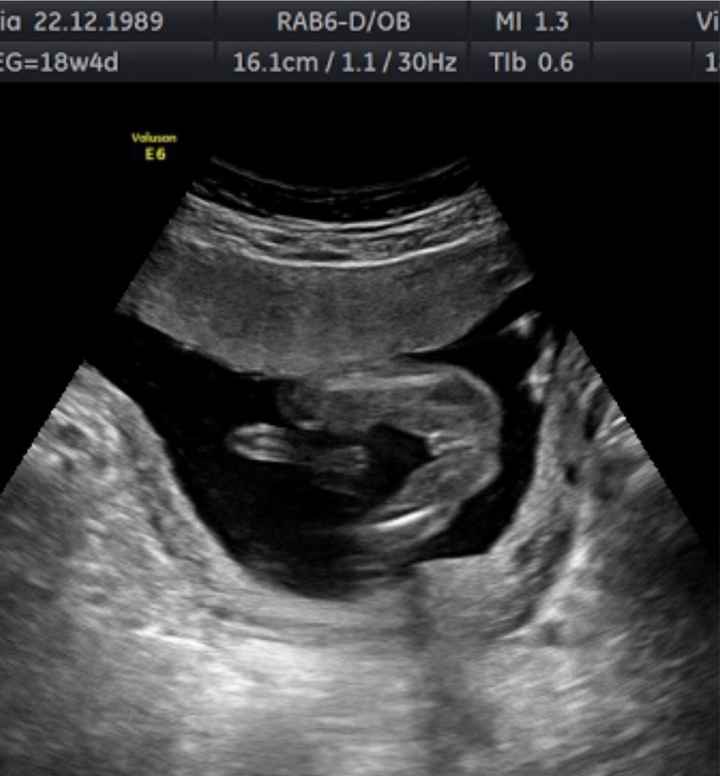 Futuras mamas Diciembre 2020 - 1
