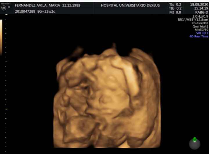 Futuras mamas Diciembre 2020 - 1