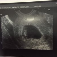 Futuras mamas julio 2016 - 1