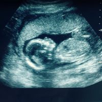 Futuras mamas julio 2016 - 1