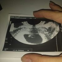 Futuras mamás abril 2017 - 1