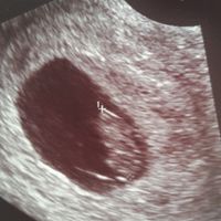  Mamás para Mayo de 2018!!! - 1