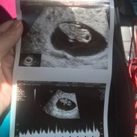 Futuras mamás diciembre 2021 ☃️ - 1