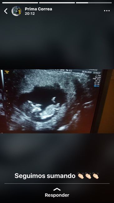 Ayuda con método ramzi: niño o niña? - 1