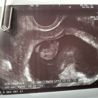 Futuras mamás octubre 2021 - 1
