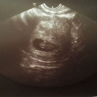 Ayuda con método ramzi: niño o niña? - 1