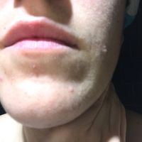 Granos antes de la boda - 1