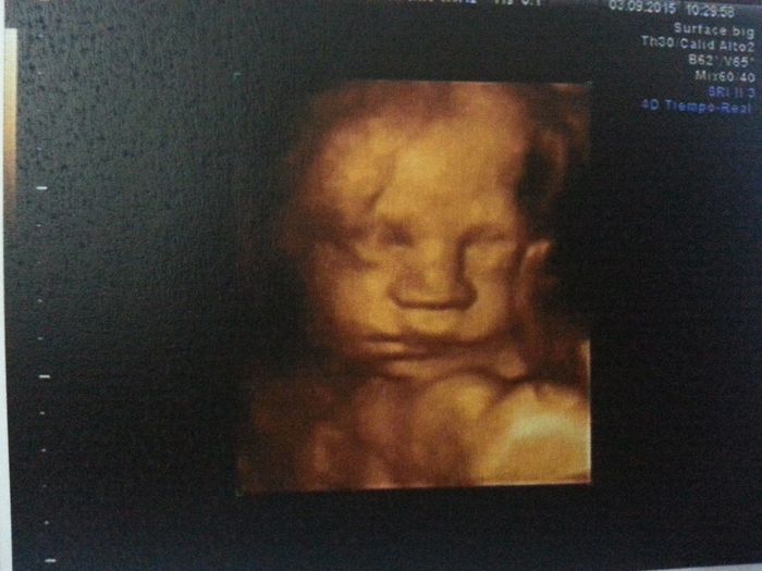Ángel - 29 semanas