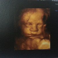 Ángel - 29 semanas